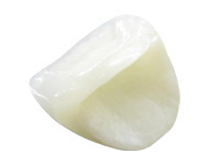 �C�[�}�b�N�X